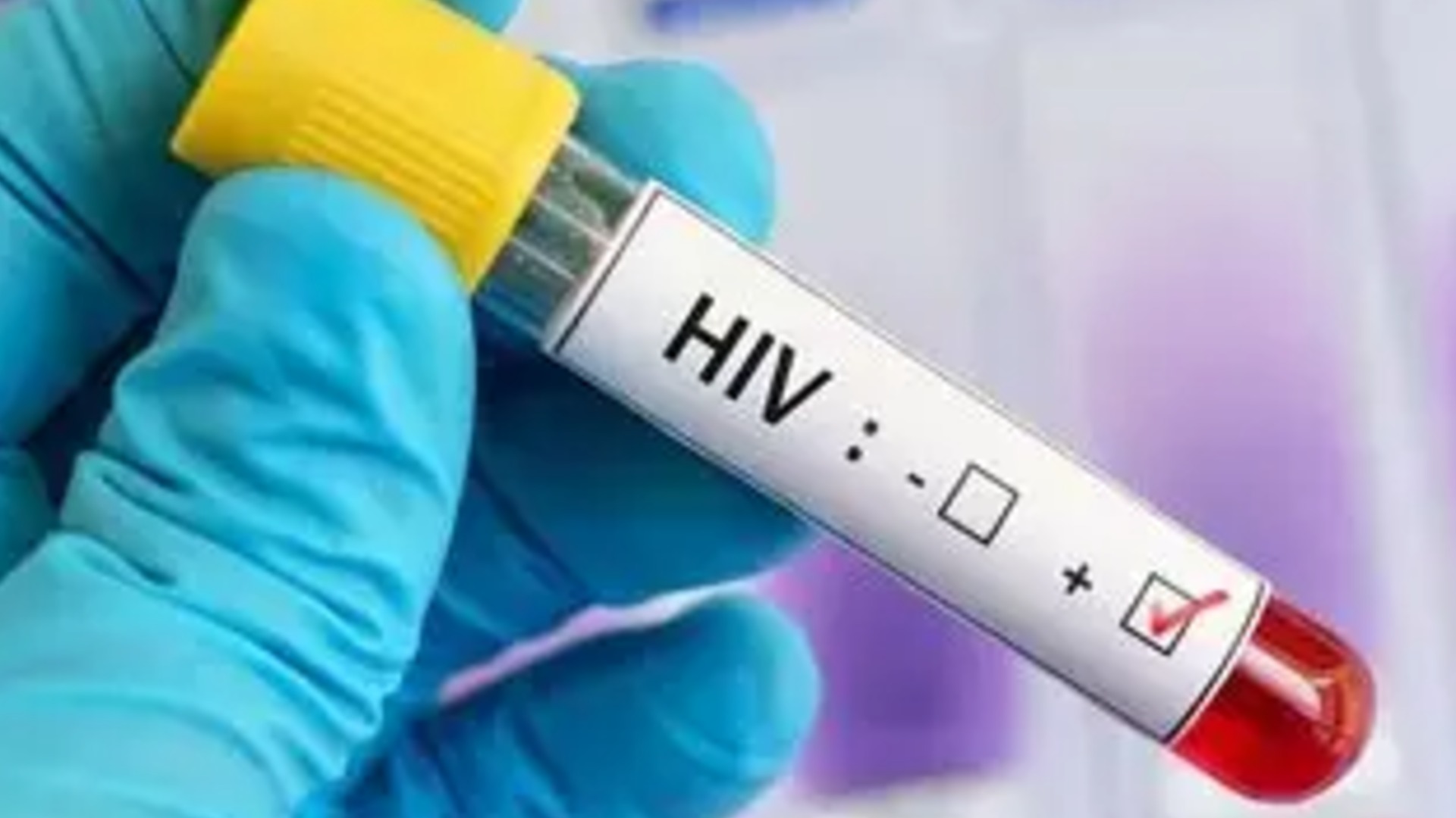 Ministry warns people with HIV not to stop treatment over herbal cure claims